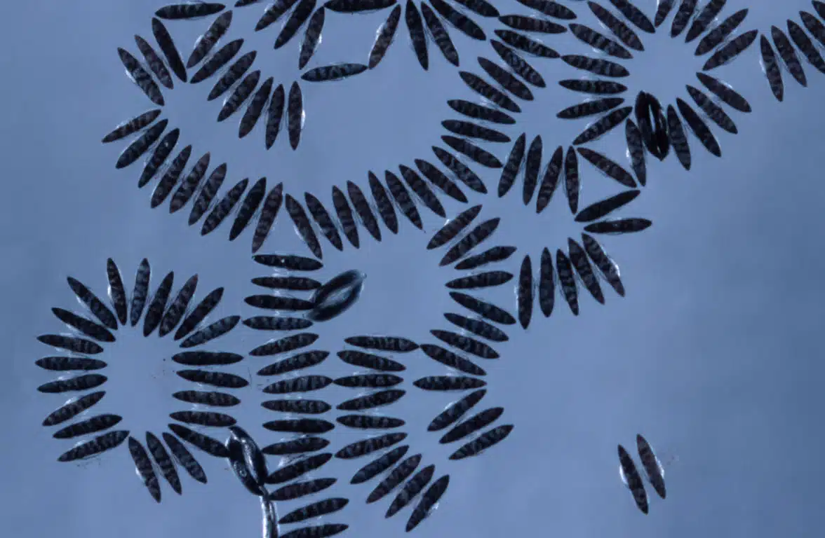 resistance-management-img